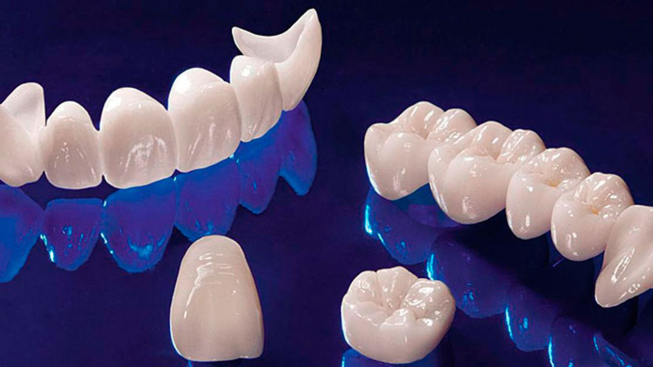 bezmetallovaya-keramika-1-1