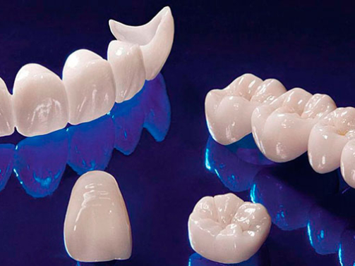 bezmetallovaya-keramika-1-1