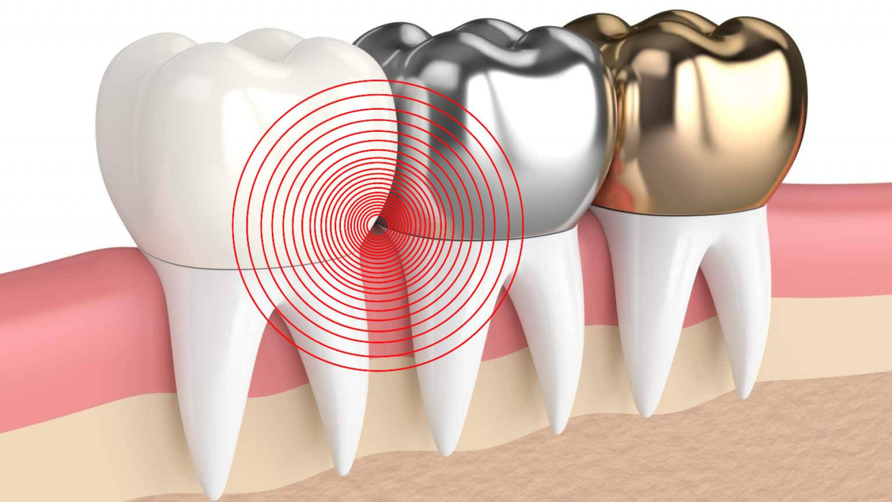 tooth-hurts-under-crown