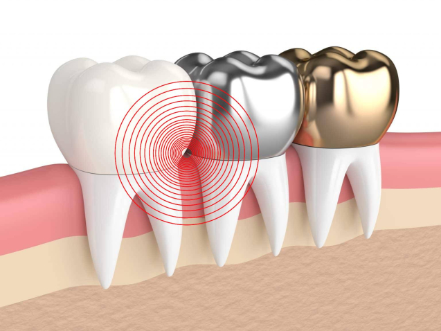 tooth-hurts-under-crown